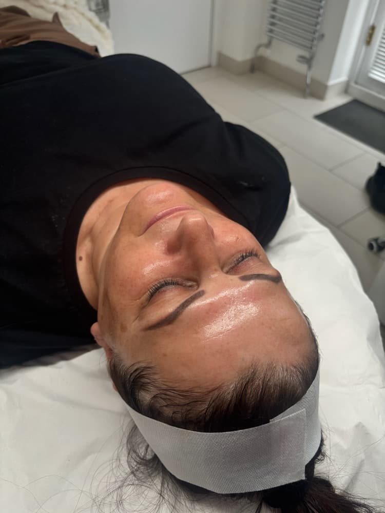 Fresh, glowing skin after a facial