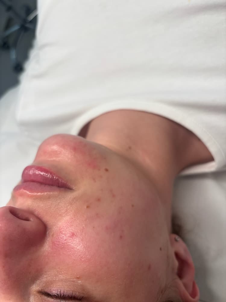 Glowing skin result after a facial
