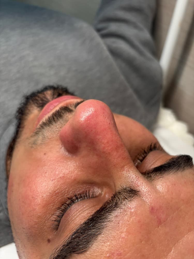 Skin treatment at the Cuffley studio